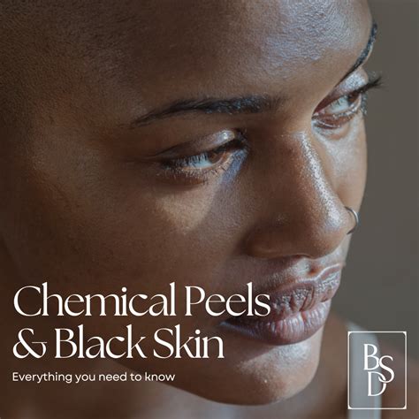 Chemical Peel Black Skin Melanage Chemical Peel Skin Pigmentation Acne