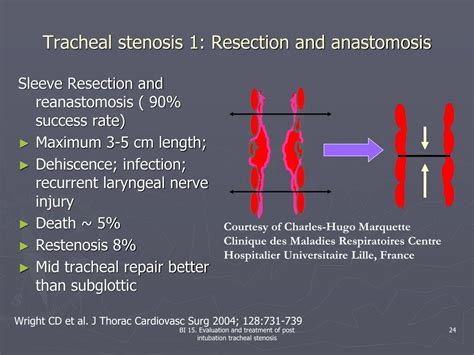 PPT - Evaluation and treatment of post intubation tracheal stenosis PowerPoint Presentation - ID ...