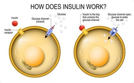 Image result for Insulin Management Algorithm