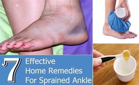 7 EFFECTIVE HOME REMEDIES FOR SPRAINED ANKLE! | Sprained ankle, Sprain ...