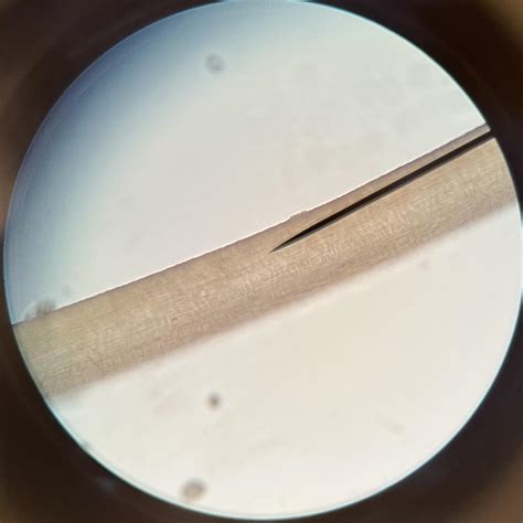Unhealthy Hair Under Microscope Looking At Damaged Hair Under A
