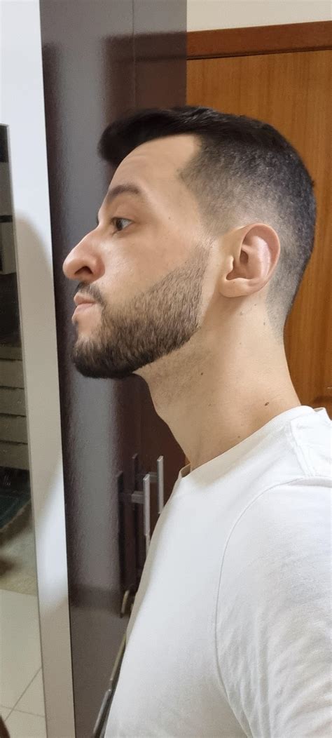 Stubble Beard Neckline