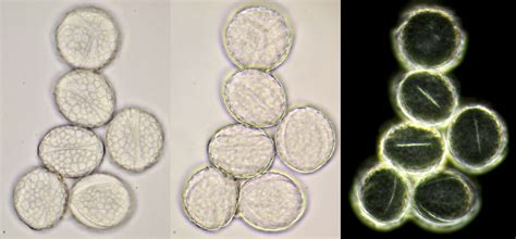 Pollen Under Microscope 100X at Rosemary Henry blog