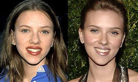 Bildergebnis für celebrities+that+have+plastic+surgery