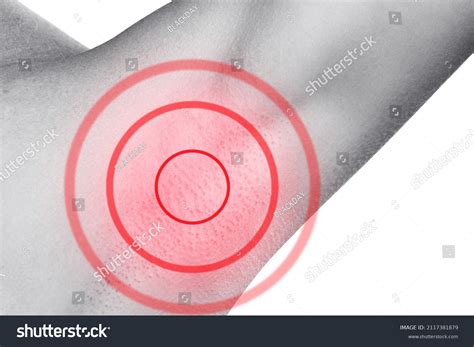 Armpit Sores Painful