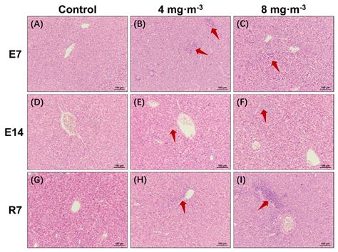 Exposure to Particulate Matter in the Broiler House Causes Dyslipidemia ...