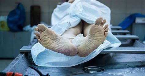 Image result for Dissection Human Postmortem