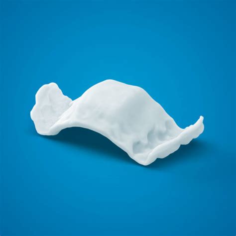 Invisalign Expander 的图像结果