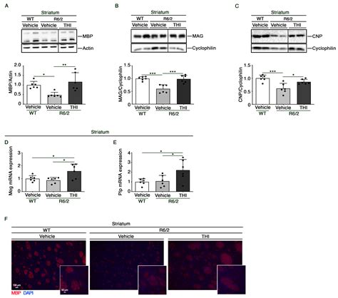 Treatment with the Glycosphingolipid Modulator THI Rescues Myelin ...