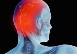 Image result for Neuralgia