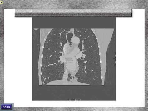 How to Run a Code Blue 的图像结果