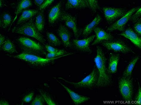 BMPR1A antibody (12702-1-AP) | Proteintech