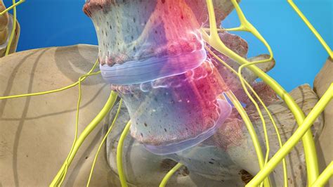 Dr. Achal Gupta | Neuron Brain & Spine Centre