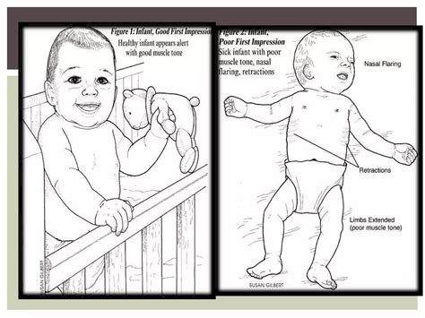 Pediatric assessment triangle | PPT
