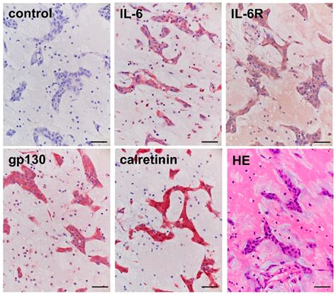 Autocrine Regulation of Interleukin-6 via the Activation of STAT3 and ...