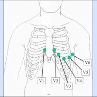 Image result for Lead Optimization Mapper Algorithm