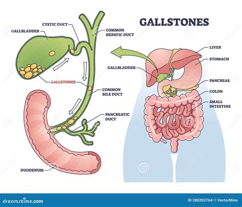 Gall Bladder Diagram