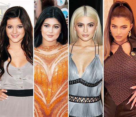 Kardashian-Jenners Plastic Surgery: Before and After Photos