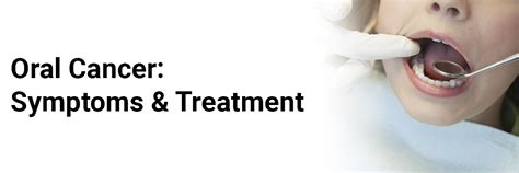 Oral Cancer: Symptoms & Treatment