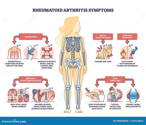 Rheumatoid Arthritis Symptoms with Joint Inflammation Disease Outline Diagram Stock Vector ...