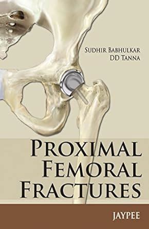 Proximal Femoral Fractures eBook : Babhulkar, Sudhir, Tanna, DD: Amazon ...