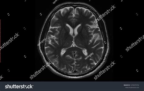 High Res Brain Scan Image 的图像结果
