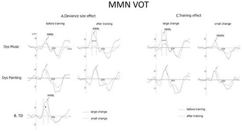 Music Training Positively Influences the Preattentive Perception of ...