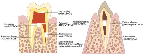 Bioceramics in Endodontics: Updates and Future Perspectives