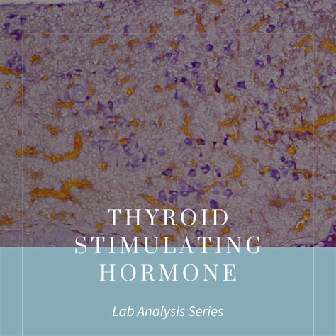 Image result for TSH