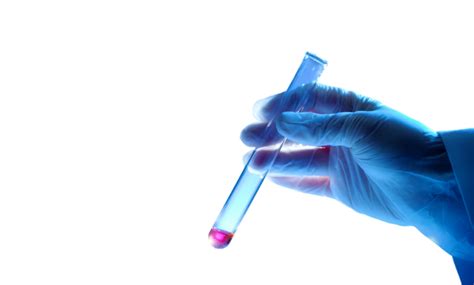 Image result for Cell-Free DNA Testing