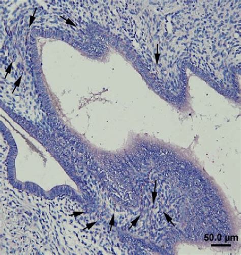 Image result for Endometrium Functional Layer