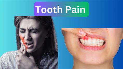 Tooth Pain (Toothache): 5+ Causes & Best Treatment Options