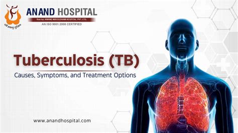 Tuberculosis Symptoms And Treatment Tuberculosis And Chest Service