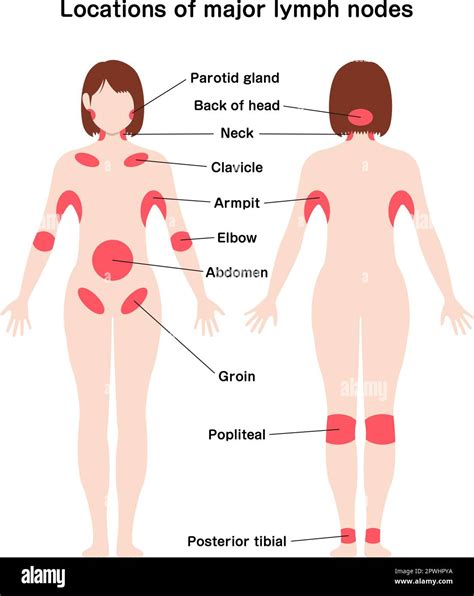 Lymph Nodes In Groin Area Female Hodgkin Lymphoma Information | Mount