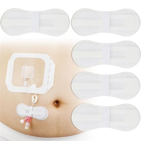 Terrifi Catheter Stabilization Device 5 Pack Catheter Stabilization ...
