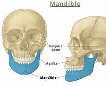 Maxilla 的图像结果