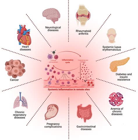 Systemic Illness là gì? Tìm Hiểu Nghĩa, Ví Dụ Câu và Cách Sử Dụng
