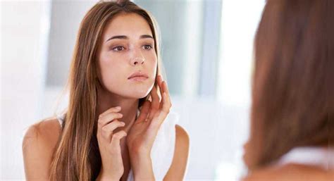 DIY remedies that'll get rid of nose acne! - Misskyra.com