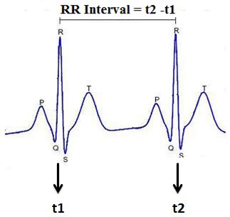 Image result for R-R Interval Calculation for ECG Code in Python
