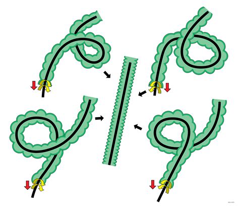 Image result for Colonoscopy Sigma Loop