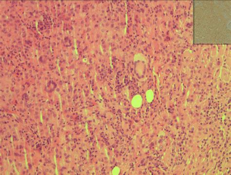 Role of fine needle aspiration cytology in the diagnosis of juvenile ...
