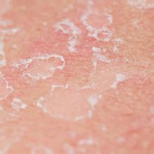 Outsup Wax Powder for Hair Removal for Women & Men | Painless & Quick ...