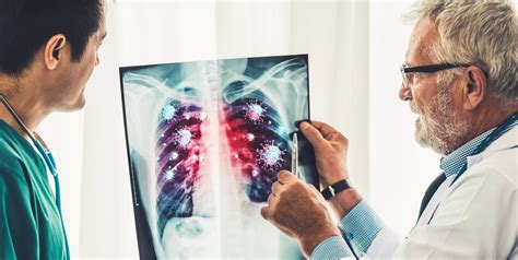 MAC Lung Disease: Causes, Symptoms, and Treatment