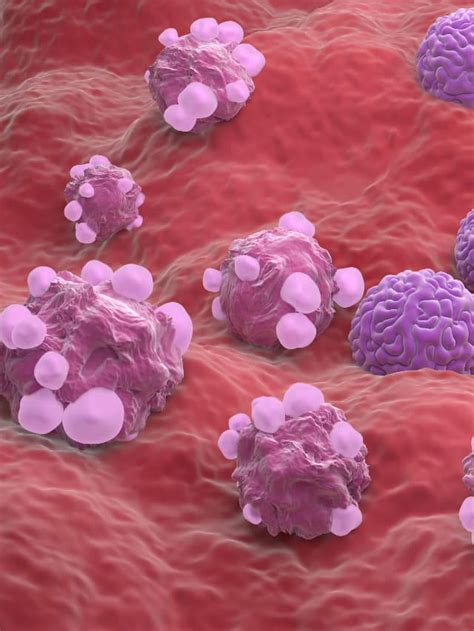 World Cancer Day 2025: Cancer-Causing Foods: What to Avoid