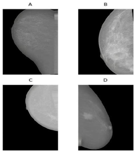 Breast Cancer Detection with an Ensemble of Deep Learning Networks ...