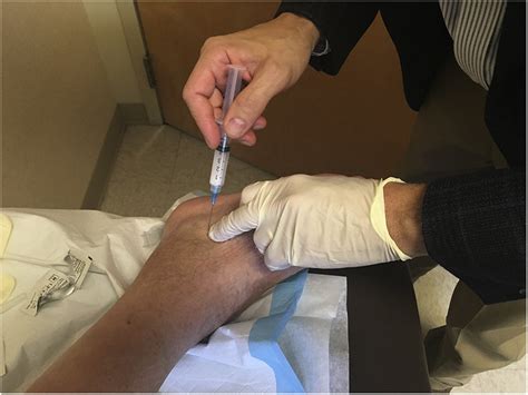 Image result for Ankle Injection Lateral Approach