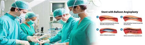 Angioplasty Surgery In Bangladesh, Angioplasty Surgery Hospital Bangladesh
