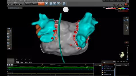 Philips Azurion 7 M12 | Image Guided Therapy System