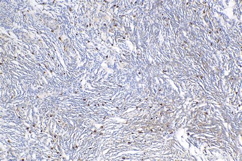 CD63 antibody (25682-1-AP) | Proteintech