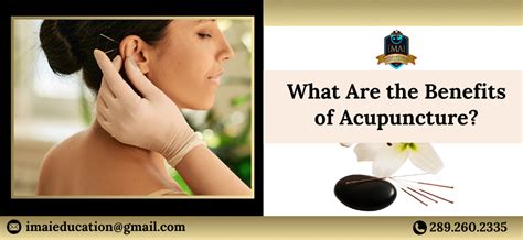 What Are the Benefits of Acupuncture?